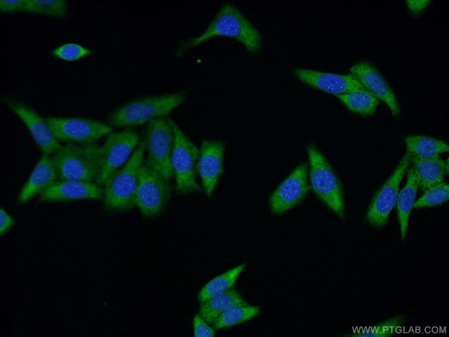UPF3A Antibody in Immunocytochemistry (ICC/IF)