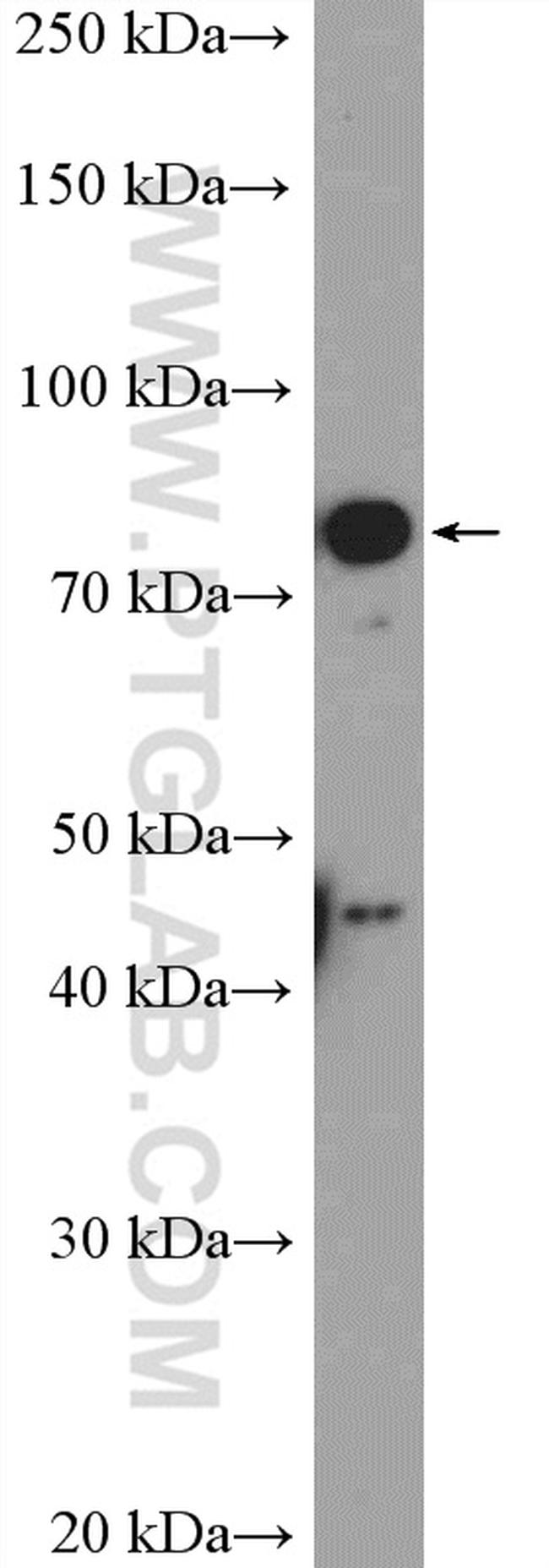 KLHL11 Antibody in Western Blot (WB)
