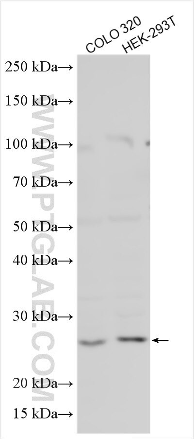 PIGX Antibody in Western Blot (WB)
