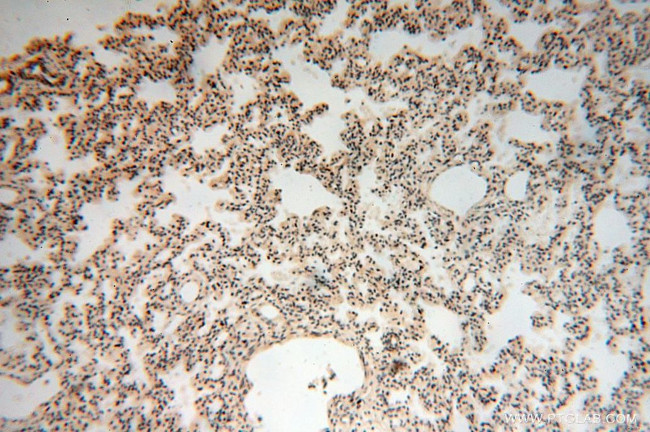 GALNTL5 Antibody in Immunohistochemistry (Paraffin) (IHC (P))