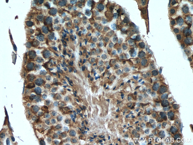 PDHA2 Antibody in Immunohistochemistry (Paraffin) (IHC (P))