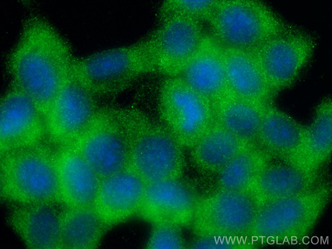 TKTL2 Antibody in Immunocytochemistry (ICC/IF)