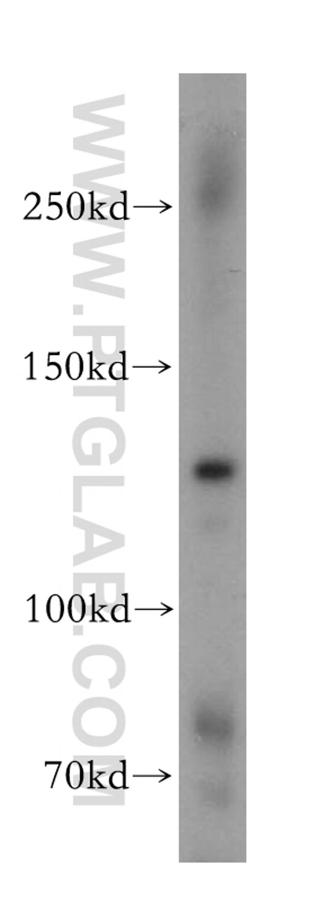RBM12B Antibody in Western Blot (WB)