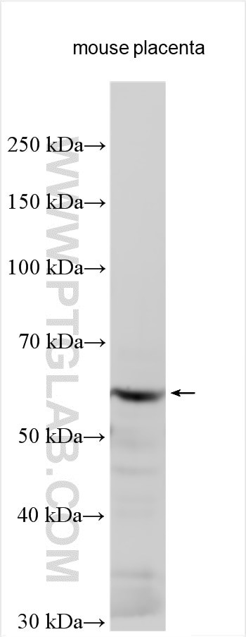 TRIT1 Antibody in Western Blot (WB)