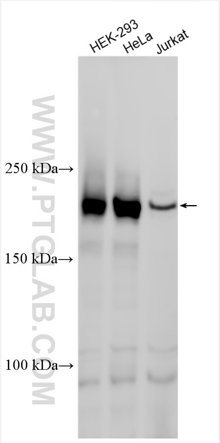 ARHGEF28 Antibody in Western Blot (WB)