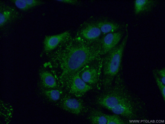 FAM160B2 Antibody in Immunocytochemistry (ICC/IF)