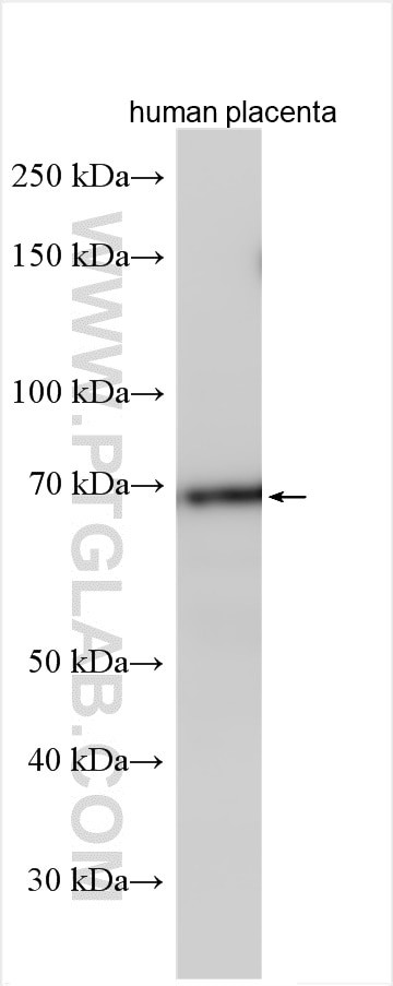 N4BP2L2 Antibody in Western Blot (WB)