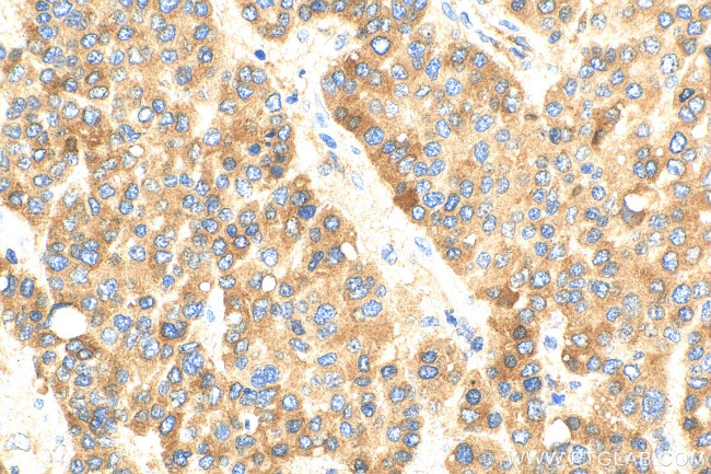 C4 Gamma Chain Antibody in Immunohistochemistry (Paraffin) (IHC (P))