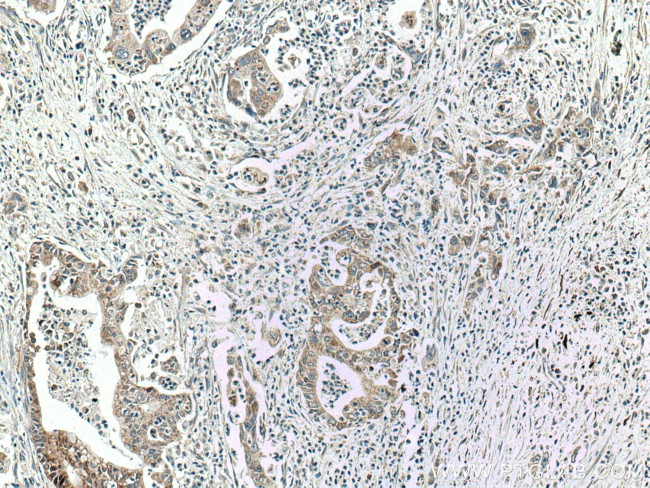 ADH1B Antibody in Immunohistochemistry (Paraffin) (IHC (P))