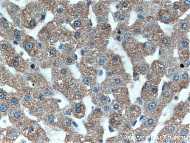 MT1X Antibody in Immunohistochemistry (Paraffin) (IHC (P))