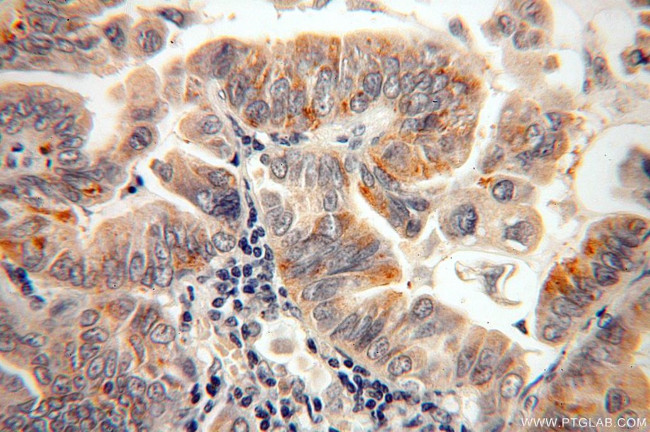 CAPSL Antibody in Immunohistochemistry (Paraffin) (IHC (P))