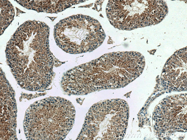 DNAJB3 Antibody in Immunohistochemistry (Paraffin) (IHC (P))