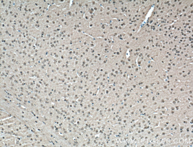 CDK10 Antibody in Immunohistochemistry (Paraffin) (IHC (P))