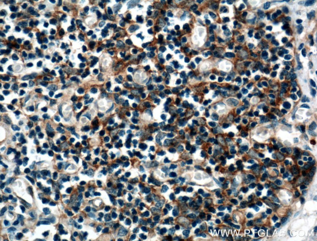 AFAP1L2 Antibody in Immunohistochemistry (Paraffin) (IHC (P))