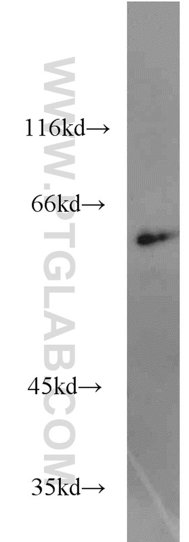 CBFA2T3 Antibody in Western Blot (WB)