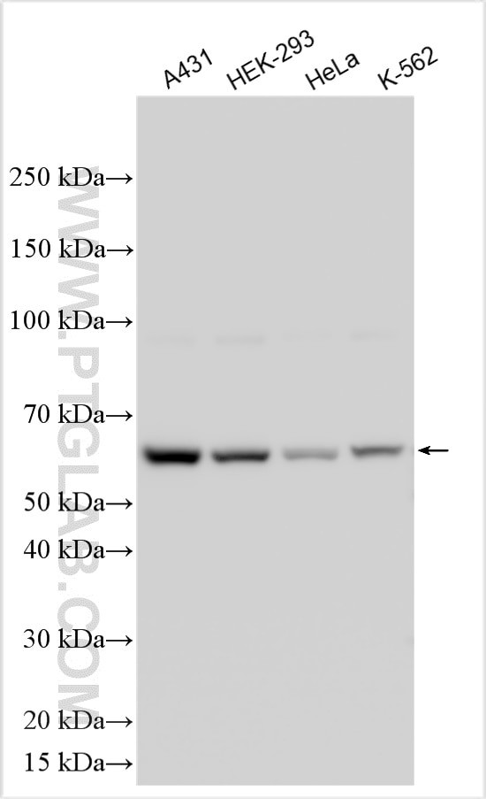 WDFY2 Antibody in Western Blot (WB)