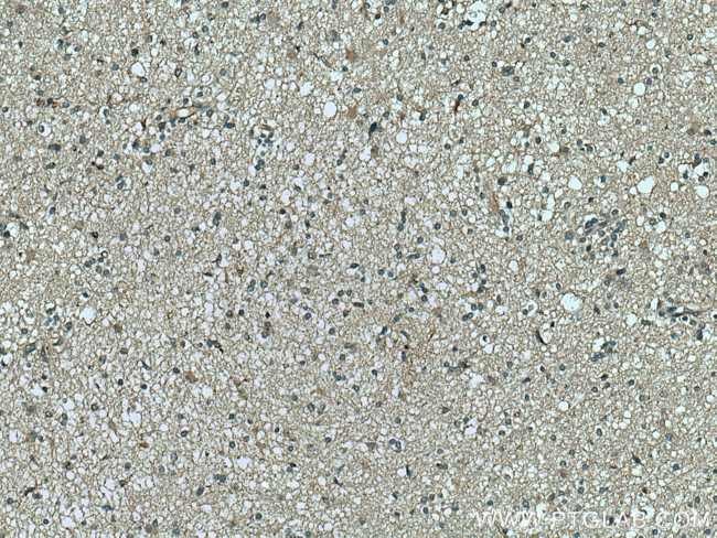 RNASE11 Antibody in Immunohistochemistry (Paraffin) (IHC (P))