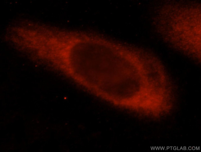 CEACAM21 Antibody in Immunocytochemistry (ICC/IF)