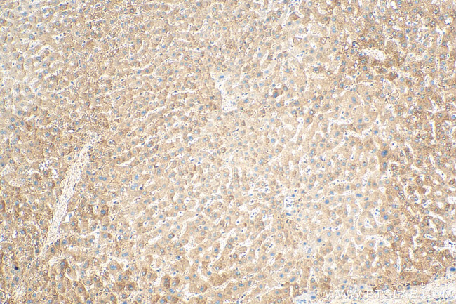MRPL50 Antibody in Immunohistochemistry (Paraffin) (IHC (P))