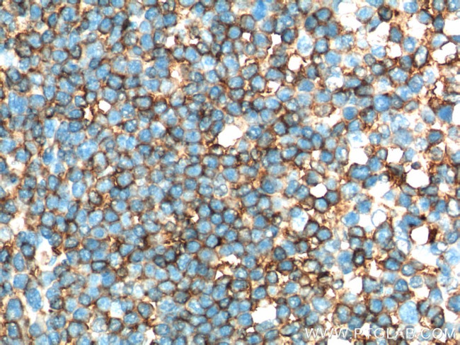 HLA-DRA Antibody in Immunohistochemistry (Paraffin) (IHC (P))