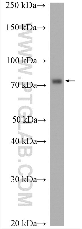 RIOK1 Antibody in Western Blot (WB)