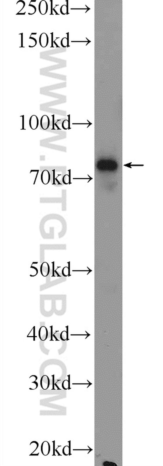 Factor XIIIa Antibody in Western Blot (WB)