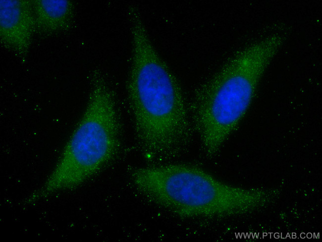 CD5L Antibody in Immunocytochemistry (ICC/IF)