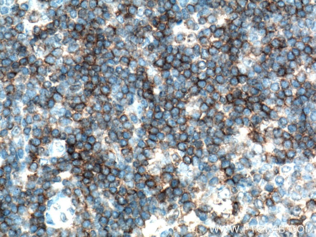 CD5 Antibody in Immunohistochemistry (Paraffin) (IHC (P))