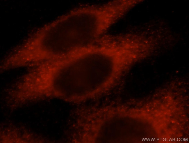 KLHL18 Antibody in Immunocytochemistry (ICC/IF)