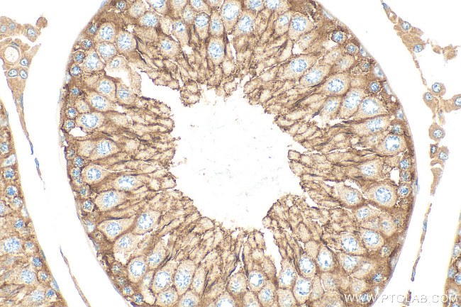 FYN Antibody in Immunohistochemistry (Paraffin) (IHC (P))