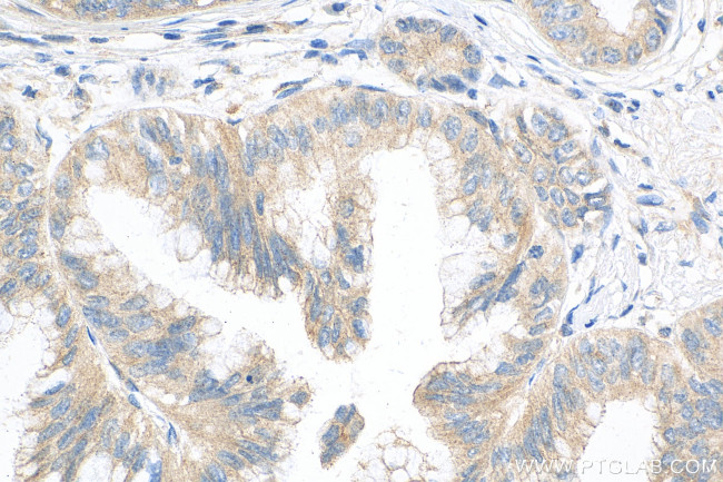 SEC16B Antibody in Immunohistochemistry (Paraffin) (IHC (P))