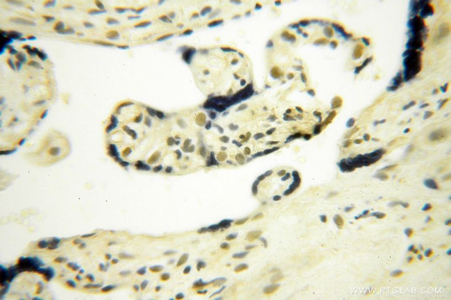 BBX Antibody in Immunohistochemistry (Paraffin) (IHC (P))