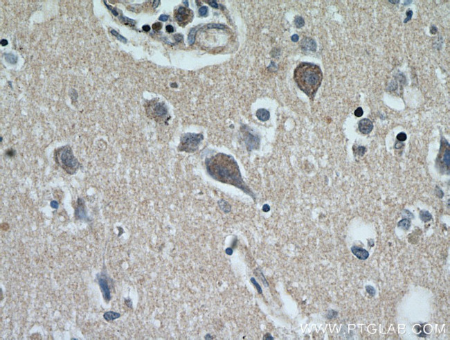 MRAP2 Antibody in Immunohistochemistry (Paraffin) (IHC (P))