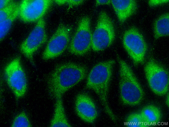 COQ10B Antibody in Immunocytochemistry (ICC/IF)
