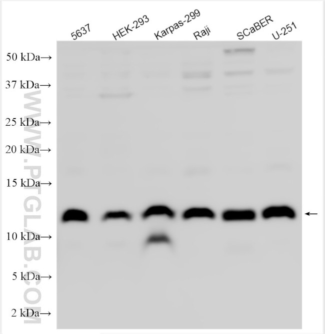 DZIP1L Antibody in Western Blot (WB)