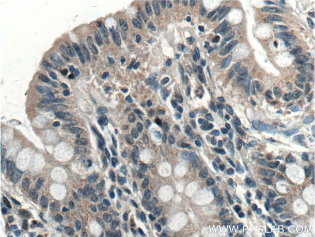 EFCAB1 Antibody in Immunohistochemistry (Paraffin) (IHC (P))