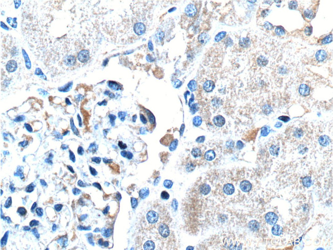 MT1M Antibody in Immunohistochemistry (Paraffin) (IHC (P))