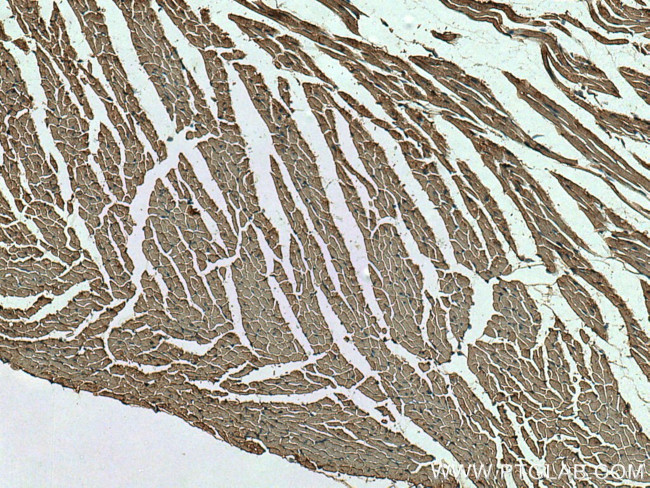 MYL7 Antibody in Immunohistochemistry (Paraffin) (IHC (P))