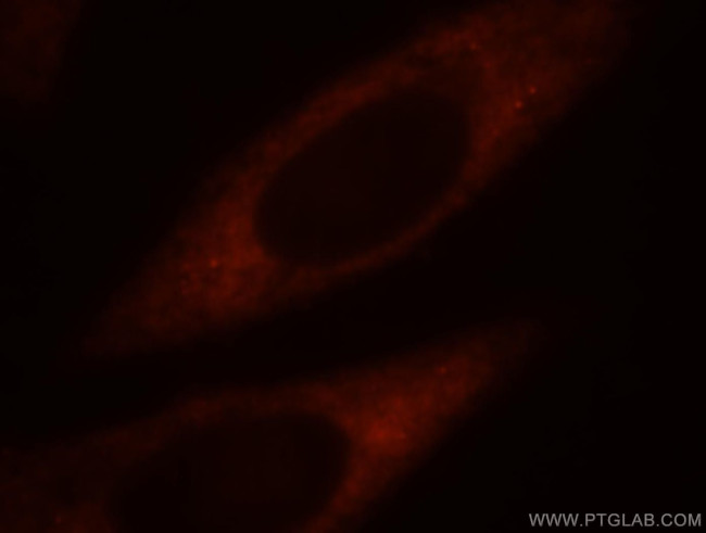 RPS4Y1 Antibody in Immunocytochemistry (ICC/IF)