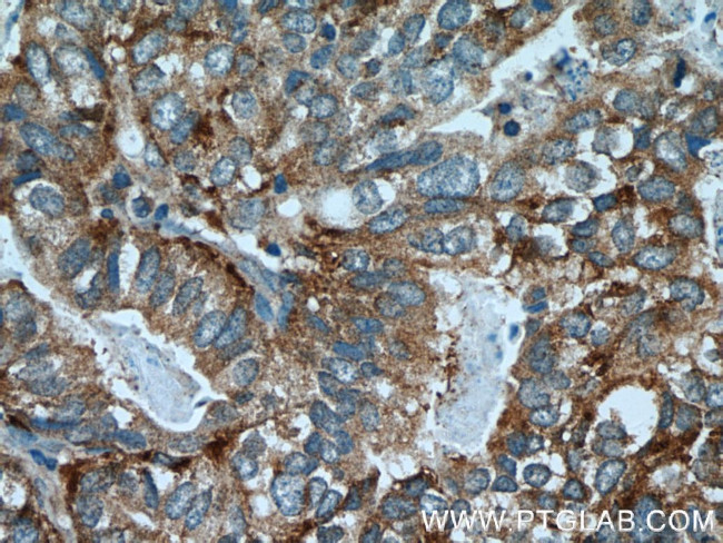 AGA Antibody in Immunohistochemistry (Paraffin) (IHC (P))