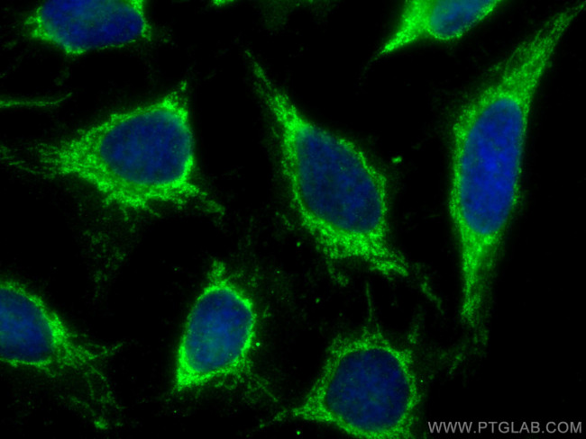 MRPL42 Antibody in Immunocytochemistry (ICC/IF)