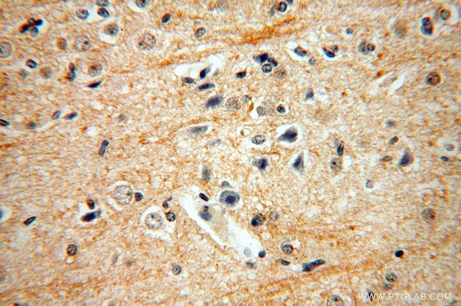ENPP4 Antibody in Immunohistochemistry (Paraffin) (IHC (P))