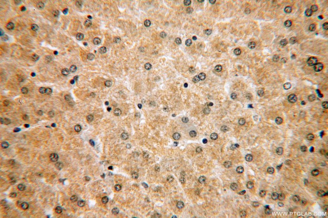 CLYBL Antibody in Immunohistochemistry (Paraffin) (IHC (P))