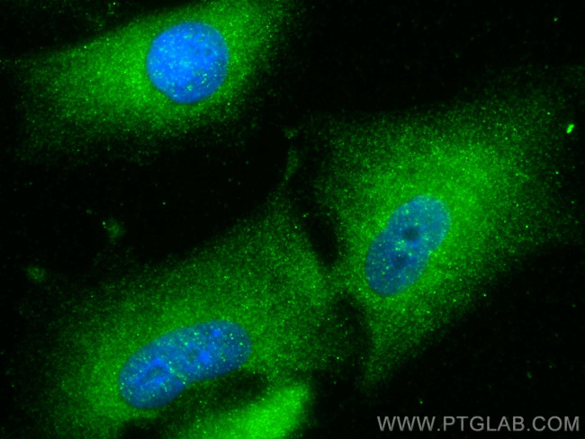 ACOT4 Antibody in Immunocytochemistry (ICC/IF)