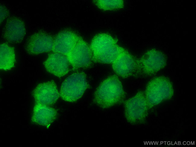 NUDT18 Antibody in Immunocytochemistry (ICC/IF)