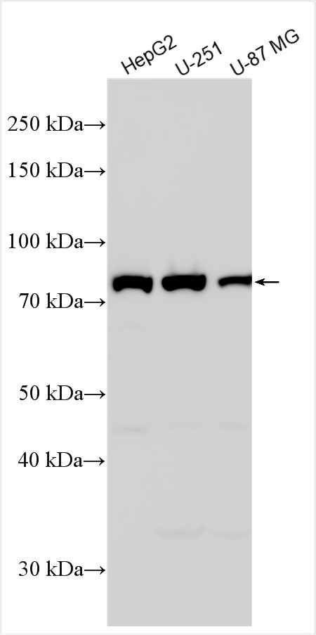 ALDH16A1 Antibody in Western Blot (WB)