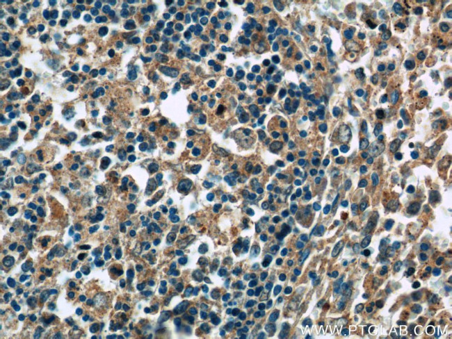 ERMP1 Antibody in Immunohistochemistry (Paraffin) (IHC (P))
