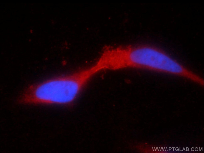 TRPV5 Antibody in Immunocytochemistry (ICC/IF)