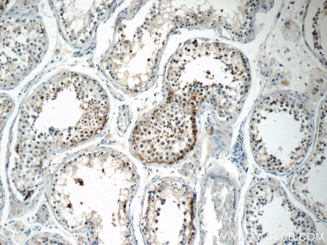 TSGA13 Antibody in Immunohistochemistry (Paraffin) (IHC (P))