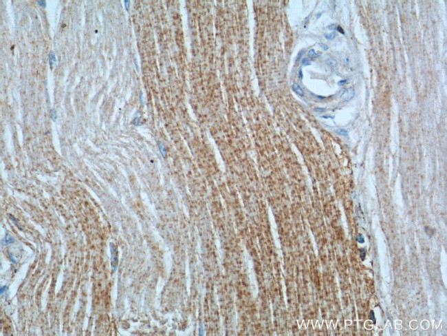DNAJC11 Antibody in Immunohistochemistry (Paraffin) (IHC (P))